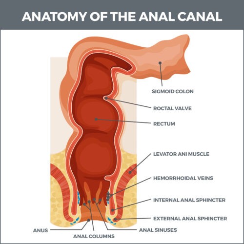 fecal-incontinence-gastro-md