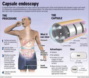 Capsule-endoscopy