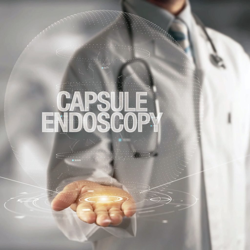 capsule-endoscopy-gastro-md