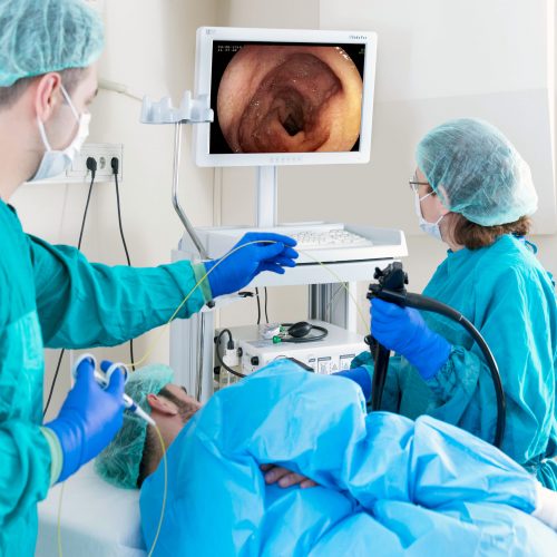 Upper GI Endoscopy | Gastro MD