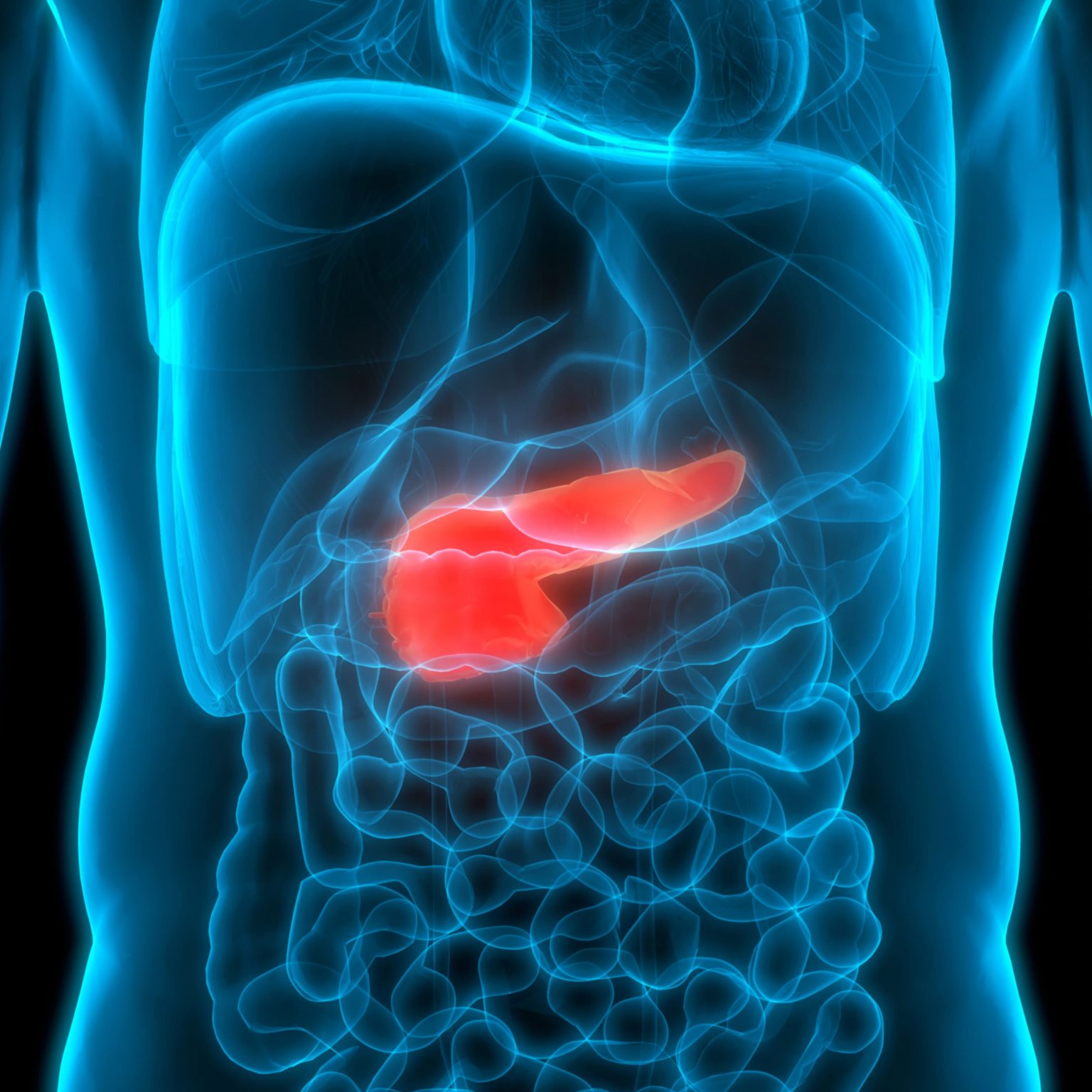 Exocrine Pancreatic Insufficiency | Gastro MD