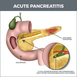 What is the Pancreas?