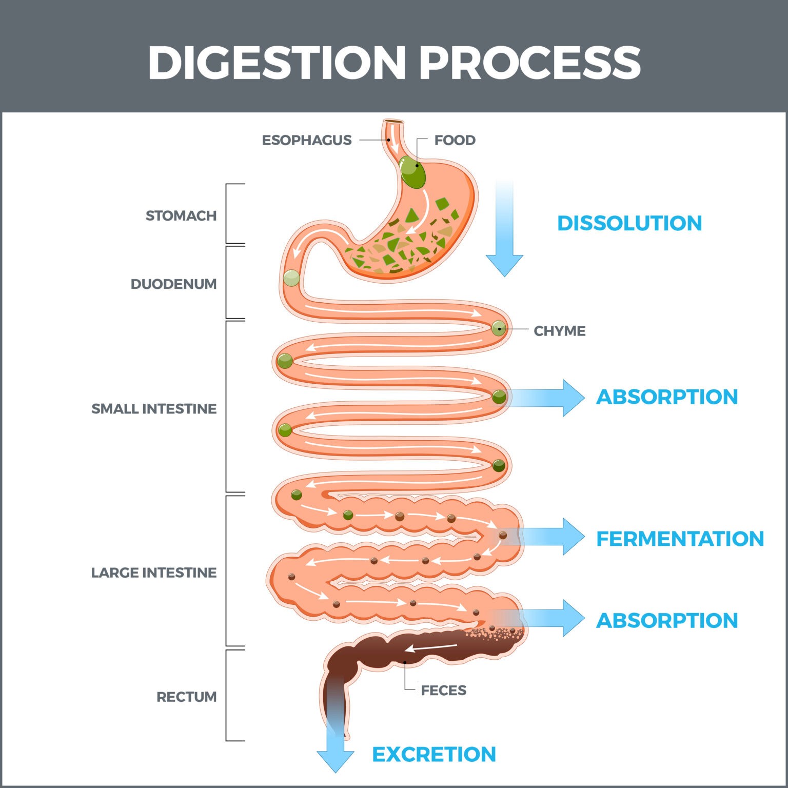Constipation Gastro MD