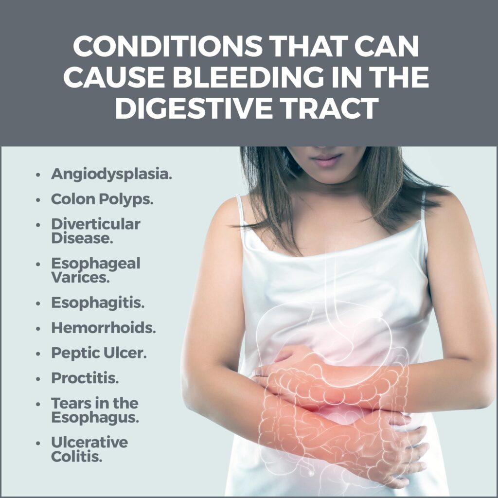 Bleeding In The Digestive Tract | Gastro MD