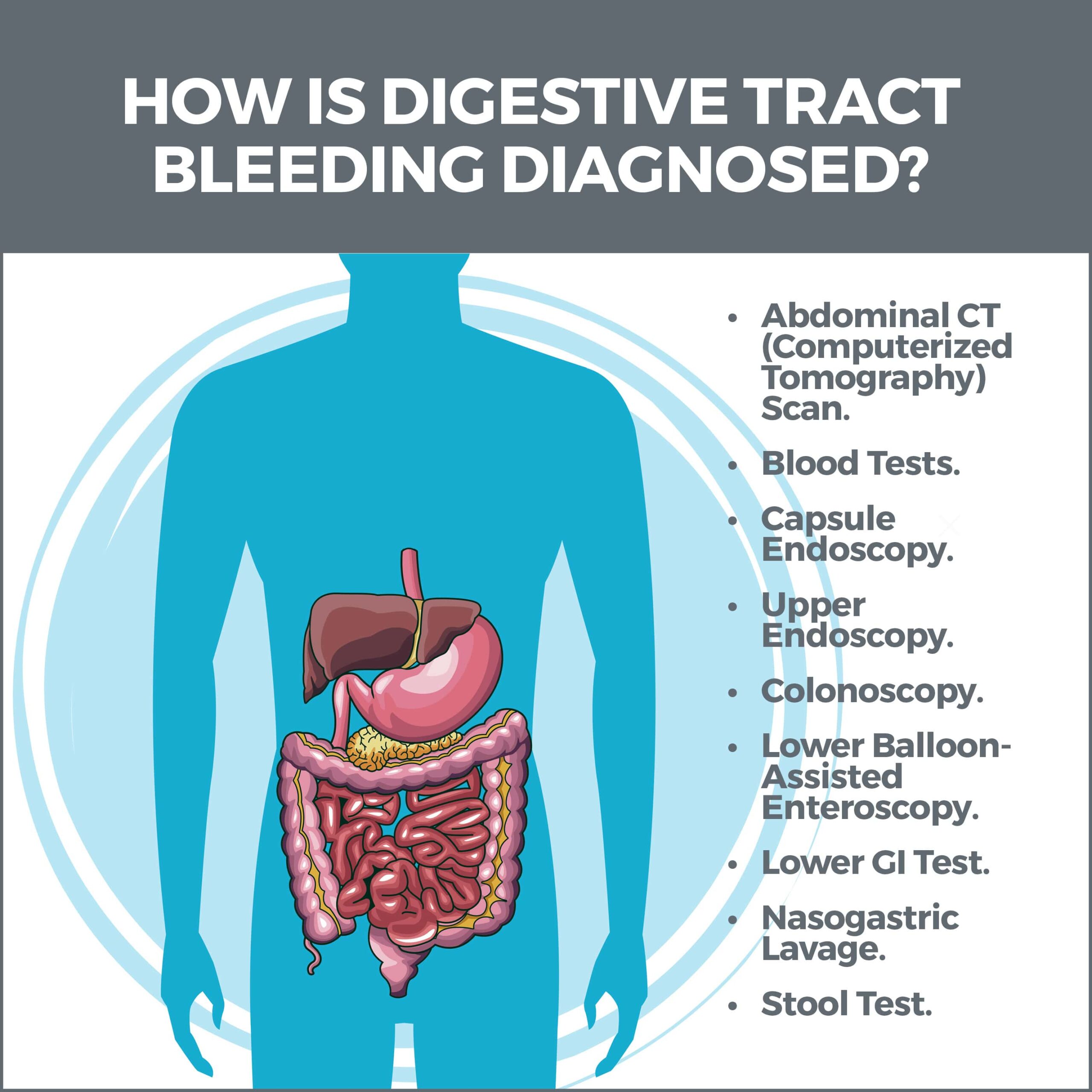 Bleeding in the Digestive Tract Gastro MD