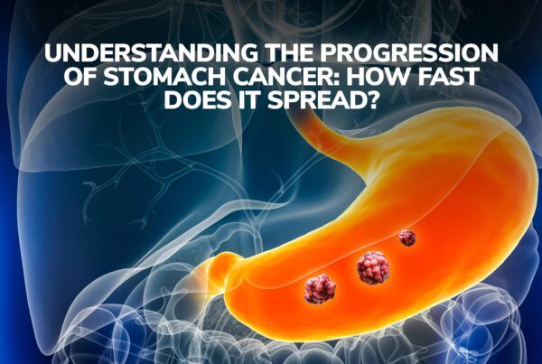 Understanding the Progression of Stomach Cancer: How Fast Does it Spread?